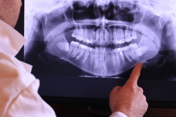 Best Emergency Treatment for Dental Infections or Abscesses in Muscle Shos, AL